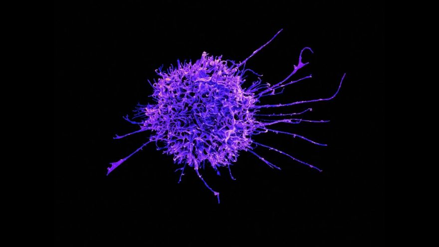 下一代 CAR-T 關鍵拼圖！《Nature Cancer》揭MM骨髓免疫圖譜